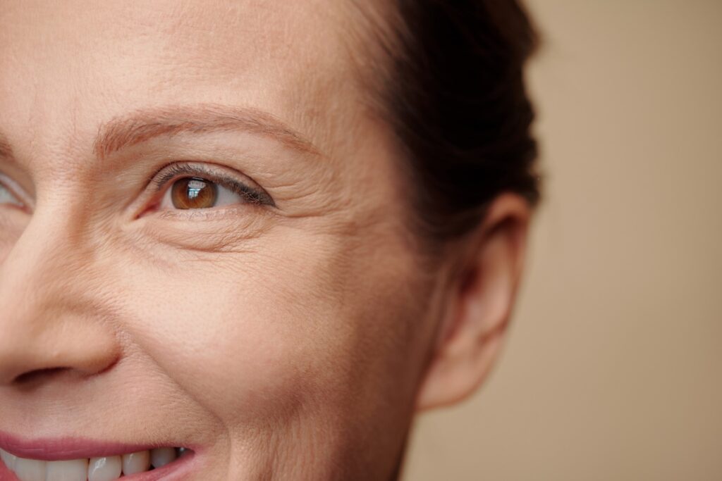 A woman smiling, her eyes crinkling. She's interested in Wrinkles Treatment in Pembroke Pines.