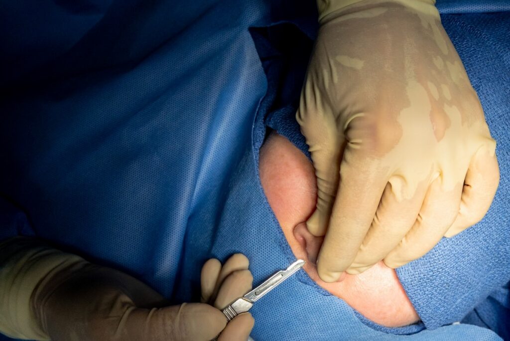 Close-up of a surgeon's gloved hands using a scalpel for a precise nose reshaping procedure in Pembroke Pines.